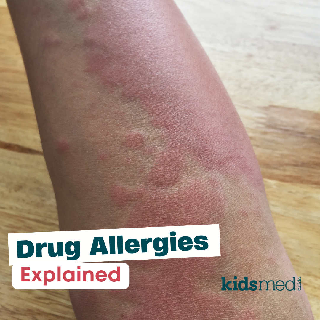 Drug Allergies Explained: A Parent’s Guide to Symptoms and Treatment